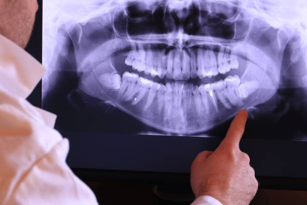 Best Urgent Care for Lost Fillings or Crowns in Hiawatha, KS
