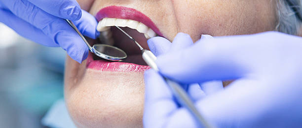 Best Emergency Tooth Extraction in Hiawatha, KS