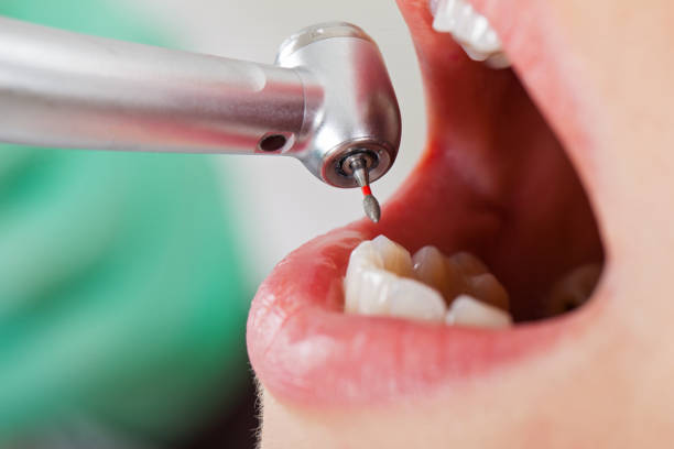 Best After-Hours Dental Trauma Care in Hiawatha, KS